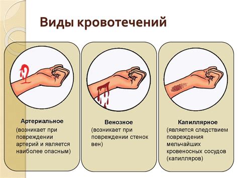 Первая помощь при кровотечении - презентация онлайн