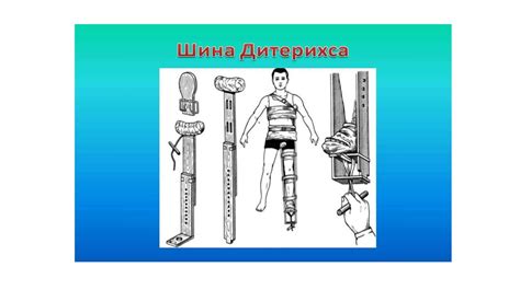 Повреждения и травмы - online presentation