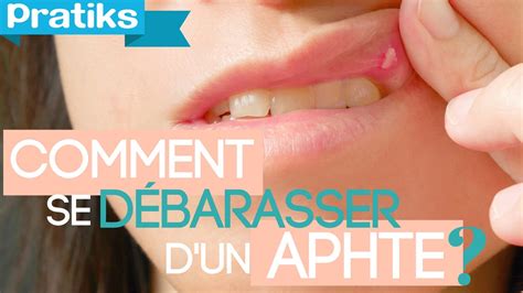 Comment Se D Barrasser D Un Aphte Pratiks