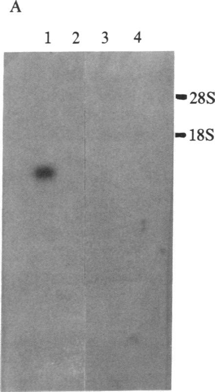 Hybridization Of Polya Rna From Different Stages Of Placental