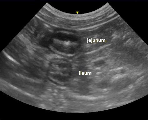 Duodenum Jejunum Ileum Cat