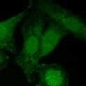 Human Mouse Rat Phospho Erk T Y Erk T Y Antibody