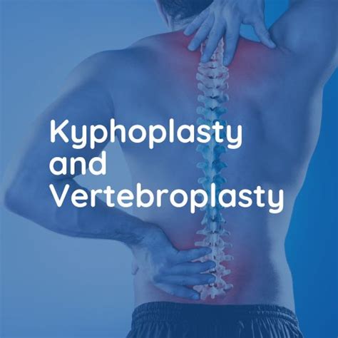 Kyphoplasty And Vertebroplasty