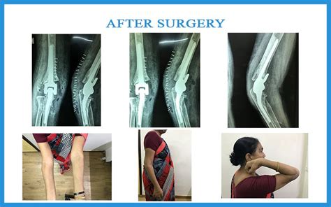 Joints Care in Ahmedabad