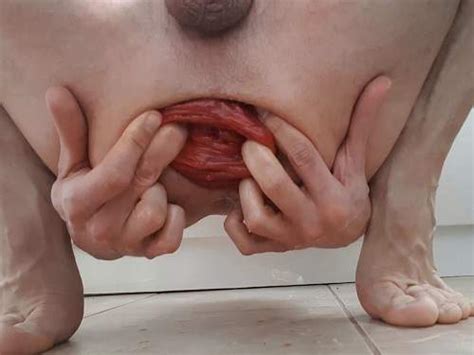 Amateur Male Hardcore Stretching His Giant Anal Prolapse Anal