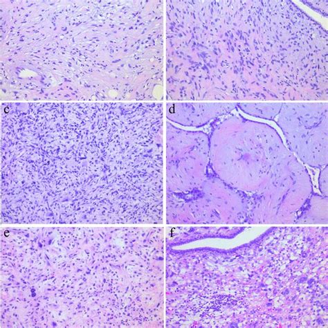 Androgen Receptor Immunohistochemistry Ihc Staining A Ihc Download Scientific Diagram