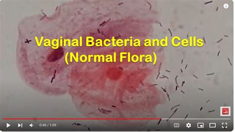 Vaginal Normal Flora High Vaginal Swab Gram Staining Epithelial