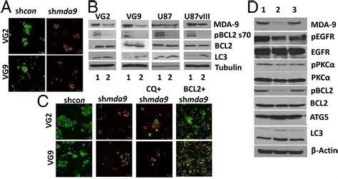 Mda Syntenin Regulates Protective Autophagy In Anoikis Resistant