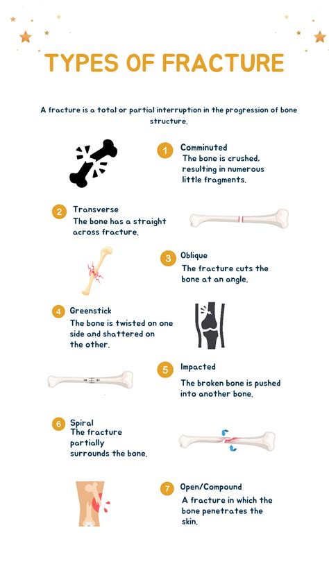 Types Of Fractures Understanding Bone Injuries The Nursing School