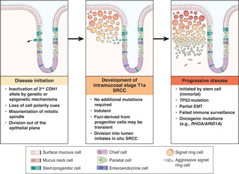 Hereditary Diffuse Gastric Cancer Gastroenterology