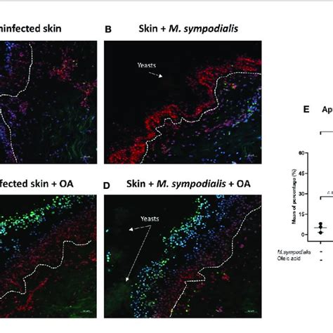 Apoptosis In Skin Apoptosis Levels Were Measured In The Four Groups