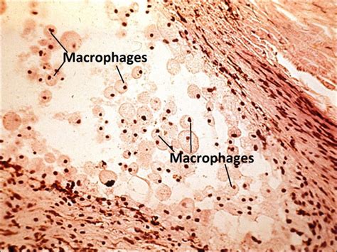 Moran Core Lens Histopathology