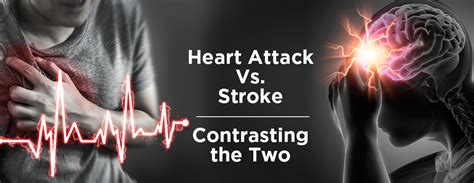 Heart Attack Vs. Stroke: Contrasting the Two - MMI