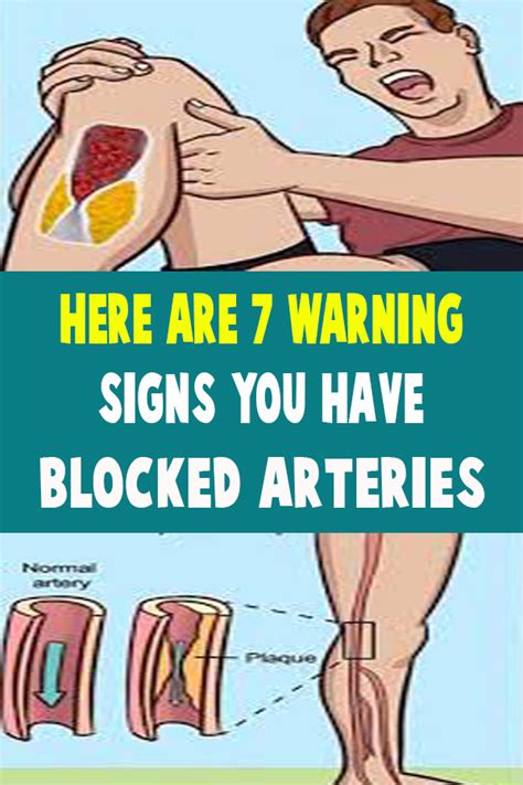 Here Are 7 Warning Signs You Have Blocked Arteries Health Tips