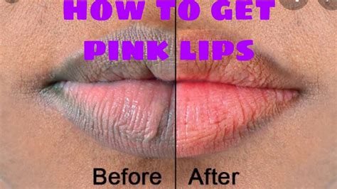 How To Get Pink Lips Naturallyhow To Make Your Lips Soft Naturally Youtube