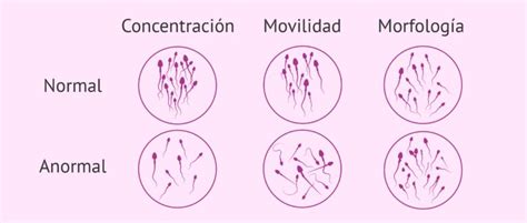 Cómo se interpretan los resultados del seminograma y sus valores