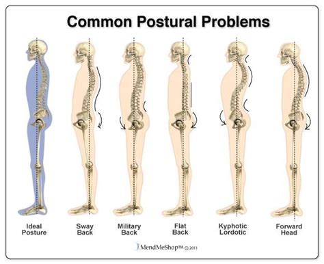 Posture Types Body Systems Human Body Info Upper Back Exercises Improve Posture Back