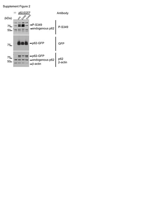 Phosphorylation Of Serine 349 Of P62 In Alzheimers Disease Brain