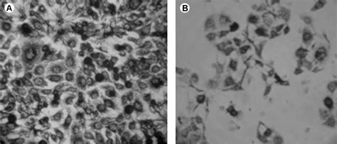 Scielo Brasil Cytotoxic Effects Of Zoledronic Acid On Human