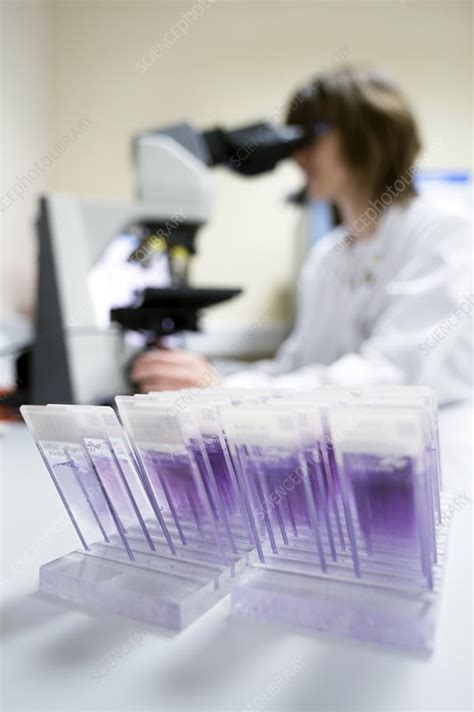 Blood sample analysis - Stock Image - C023/2957 - Science Photo Library