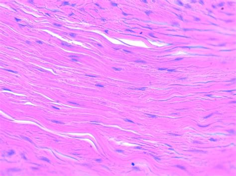 dense regular connective tissue