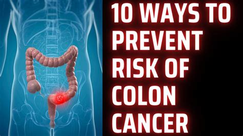 10 Ways To Stop Colon Cancer Reduce Risk Of Colon Cancer Youtube