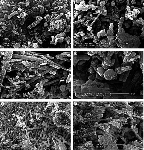 Sem Photographs Of Infill Sediment Showing Nannograin Texture A And