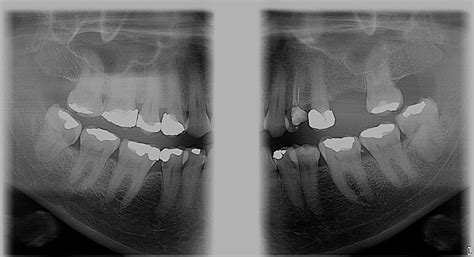 Radiograf As Maxilodent Centro De Radiolog A Digital Oral Y