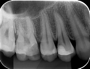 Overview Of Radiographic Findings Exam 1 Flashcards Quizlet