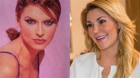 Brandi Glanville S Bad Plastic Surgery Breast Augmentation