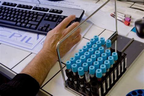 Gr Ve Des Laboratoires D Analyse Un Accord Trouv Avec L Assurance