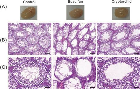 Pathology Of Testes In Induced Cryptorchidism And Busulfan Treated