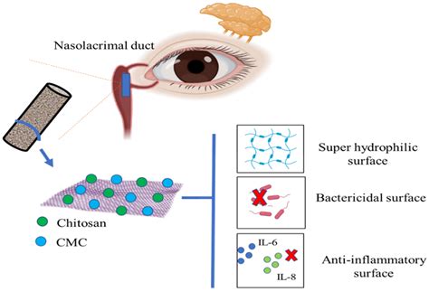 Polysaccharides Free Full Text Polysaccharide Based Implantable