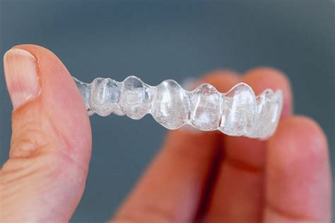 How Long Does Invisalign Take To Straighten Your Teeth Lodi