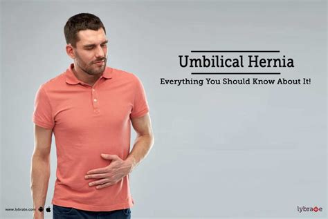 Umbilical Hernia Everything You Need To Know Nbkomputer