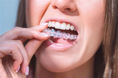 How Much Does Invisalign Cost With Without Insurance