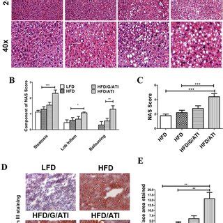 Ati Feeding Promotes Hepatic Steatosis And Inflammation A