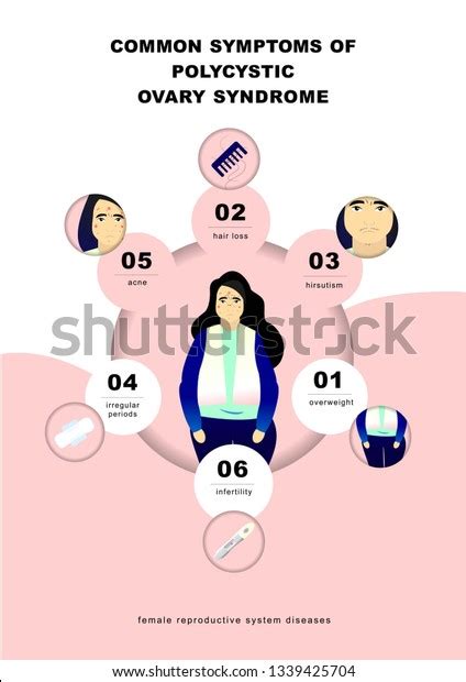 Pcos Symptoms Infographic Stock Vector Royalty Free 1339425704