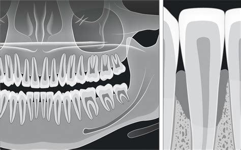 Perio Tools O Seu Portal Online Para Ferramentas Periodontais