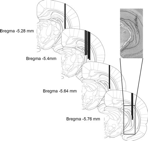 Schematic Representation Of Cannula Sites In Ventral Hippocampus With