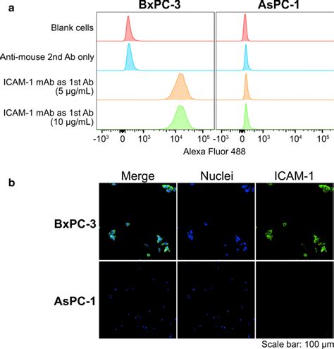 In Vitro ICAM 1 Expression In Pancreatic Ductal Adenocarcinoma PDAC