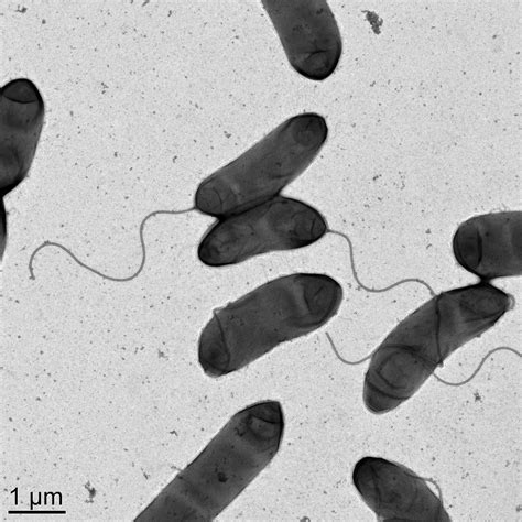 An Unusual Form Of Antibiotic Resistance In Pandemic Cholera Eurekalert Science News