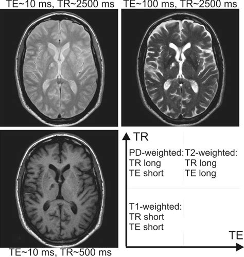 Spin Echo Magnetic Resonance Imaging Jung Journal Of