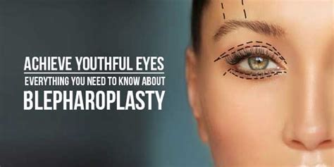 Achieve Youthful Eyes Everything You Need To Know About Blepharoplasty