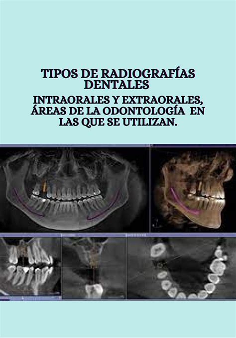 Tipos De Radiograf As Intraorales Y Extraorales By Rocio Castillo Issuu