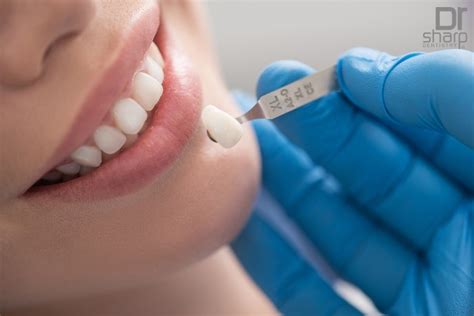 Everything You Need To Know About Dental Crowns Sharp Dentistry And