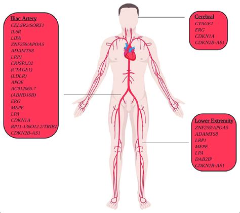 Abdominal Aortic Aneurysm Aaa Risk Loci With Aneurysmal Pleiotropy