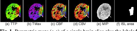 Figure 1 From Self Supervised Few Shot Learning For Ischemic Stroke