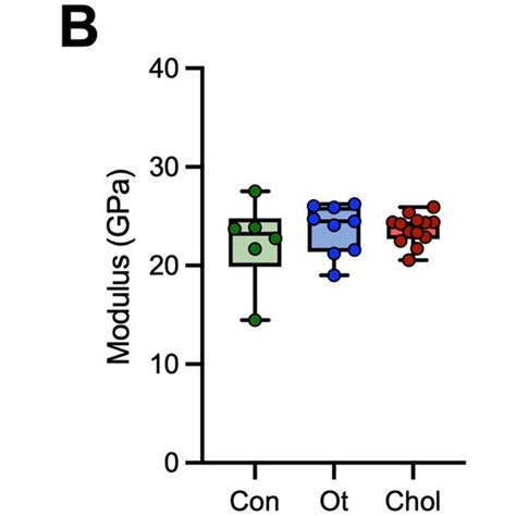 Increased Modulus Hardness Ratio As A Biomechanical Feature Of Incudes