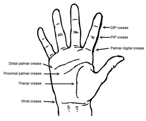 Unit 9 Anterior Hand And Wrist Flashcards Quizlet